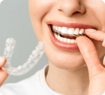 Invisalign-1