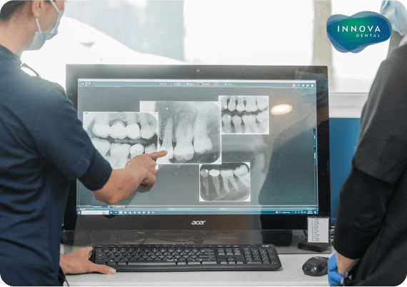 Comprehensive Dental Bridges by Innova Dental